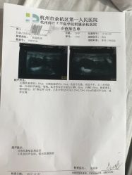 -贝喜月子会所(临平店)