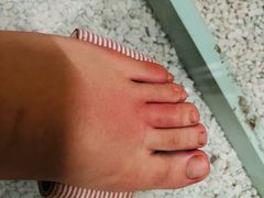 -郑远元专业修脚房(天通苑店)