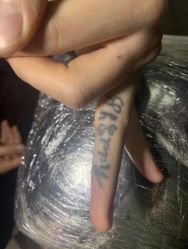 -天道专业洗纹身