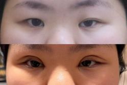 -Yestar 嘉兴艺星医疗美容医院