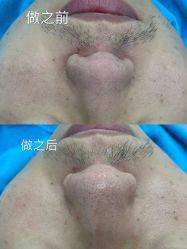 点击看大图 -蕾特恩专业祛痘·皮肤管理
