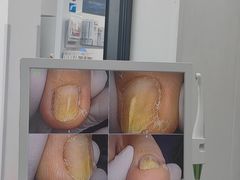 -Andrew指甲专科灰指甲·甲沟炎矫正·3D步态矫形鞋垫定制(上海法华镇路旗舰店)