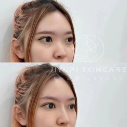 -MLP美丽派·问题肌疗愈中心