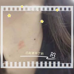 -成都军建医院·疤痕诊疗中心