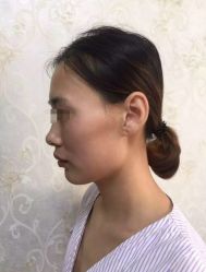 -圣嘉新医疗美容医院