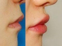 -CMS西美斯·美式医疗美容