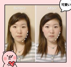 -FACE·日本小颜矫正美容整骨サロン