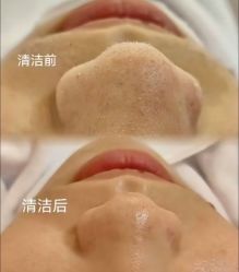-痘敏医生专业祛痘·肌肤修复连锁