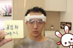 -大麦微针植发丨全国连锁