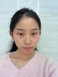 -成都西区医院整形美容