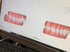 -爱雅仕口腔·数字化矫正中心(国贸门诊)