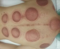 -芳朵美容养生SPA