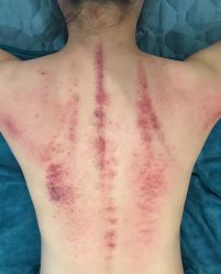 -骄阳兰多产后恢复&减龄中心(万科金域东郡店)