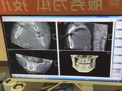 -土豆口腔(凤凰北总店)