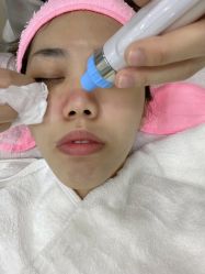 -痘博士广州·全国连锁祛痘机构