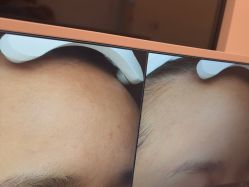 -苑苑vbeauty科技美容SPA