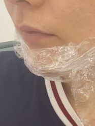 体验前-杭州奥拉克医疗美容门诊部