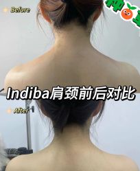 -半岛故事·法儿曼抗衰·indiba中心