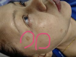 点击看大图 -智丽佳人祛斑祛痘美容美体