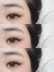 -U-Nail