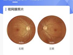 -宝岛眼镜(常熟珠江路欧尚店)