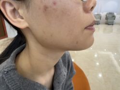 -长沙雅美医疗美容医院