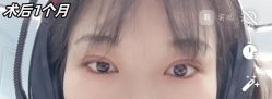 -素美医疗美容·西南眼鼻整形·修复基地