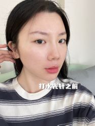 -JUVA郑州欧华医疗美容医院
