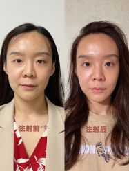 -联合丽格·张菡丽格医疗美容