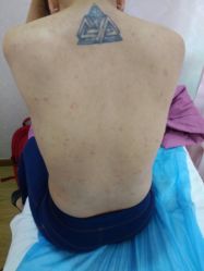 -资医堂专业袪痘袪斑