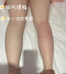 点击看大图 -Lily纤美·科技减脂中心