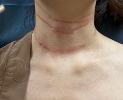 体验前-恒妍医美·韩国定制抗衰中心