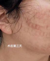 -新地崔劲松医疗美容