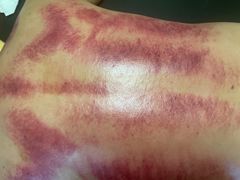 -沈师傅盲人按摩工作室(密三小区店)