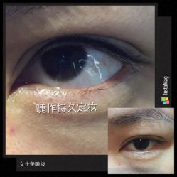 点击看大图 -光SPA科技美肤