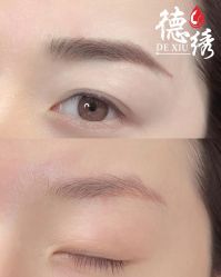-德绣·机器野生眉发际线·美瞳线半永久