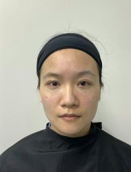 -广州健丽·去眼袋医疗美容机构
