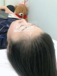 -MISS STAR·半永久纹眉·发际线·美瞳线
