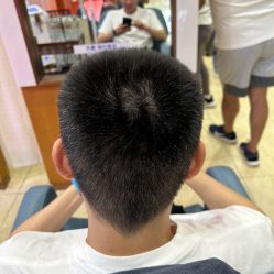-大麦微针植发全国连锁
