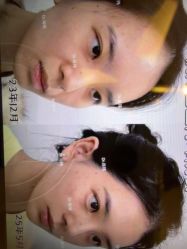 -Yestar杭州艺星医疗美容医院