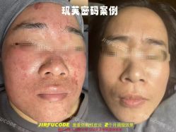 -元熙兰积皮肤管理