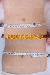 -Lily纤美·科技减脂中心