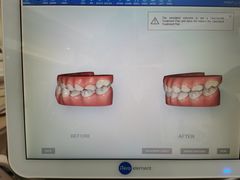 -Dr.Z dental仁康种植矫正中心