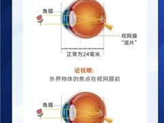 -宝视达眼镜(上街明珠公馆店)