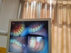 -赫尔森口腔·牙齿种植修复