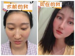 -素美医疗美容·西南眼鼻整形·修复基地