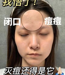 -苗方清颜痘肌研究所