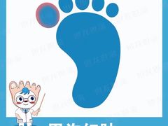 -世龙世家灰指甲鸡眼脚气甲沟炎跖疣护理(通州店)