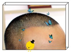 -大麦微针植发全国连锁