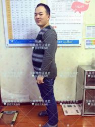 -维纳斯专业减肥